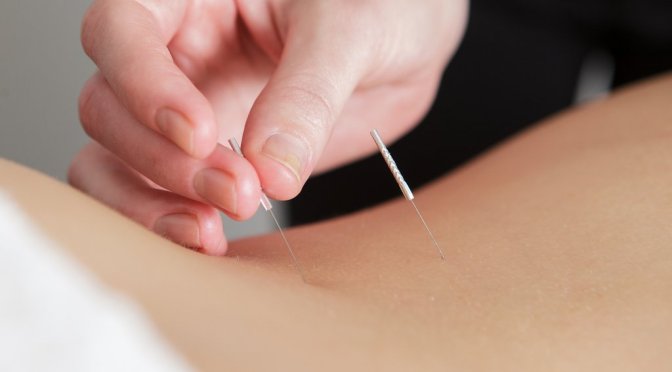 ‘Poking Long Pointy Needles’ – Needling Including Ultrasound-Guided Needling of Myofascial Trigger Points for Pain Relief